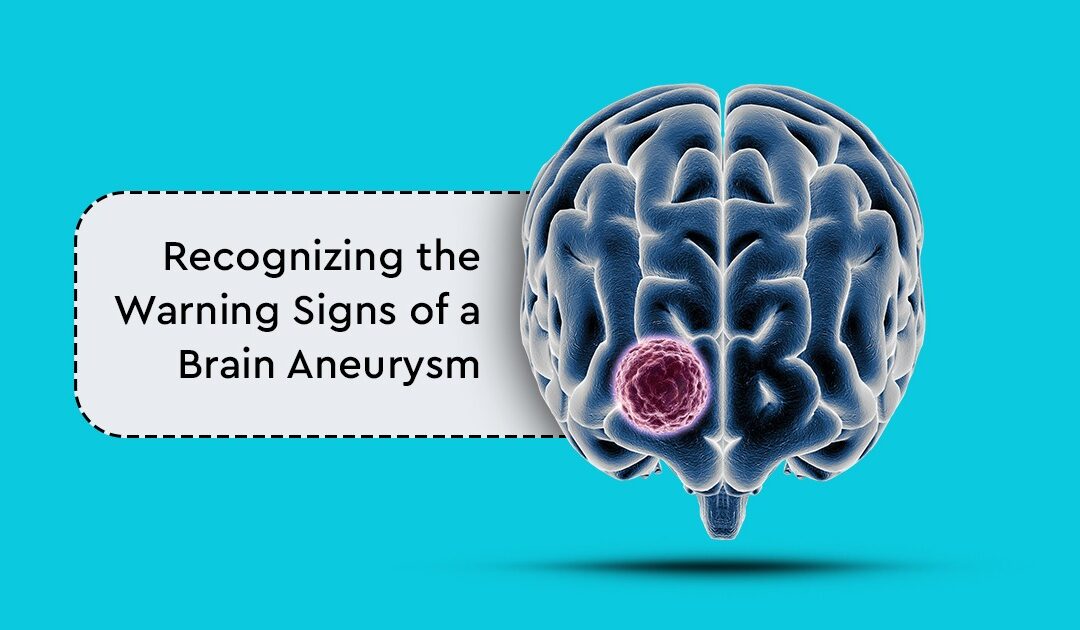 Brain Aneurysm