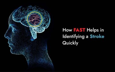 How FAST Helps in Identifying a Stroke Quickly