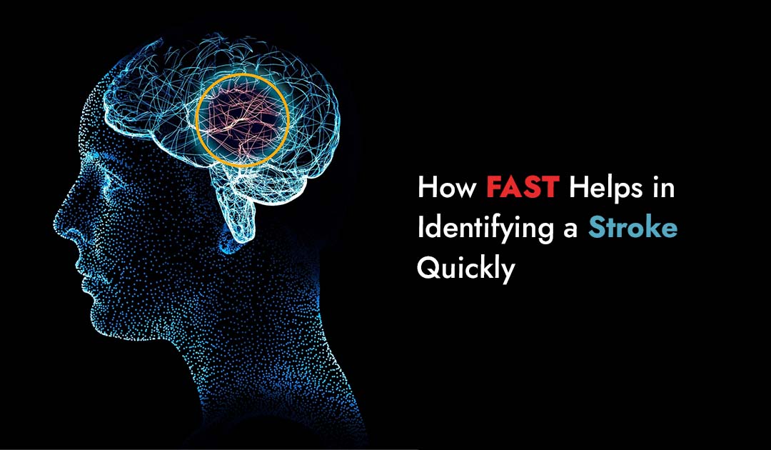 How FAST Helps in Identifying a Stroke Quickly