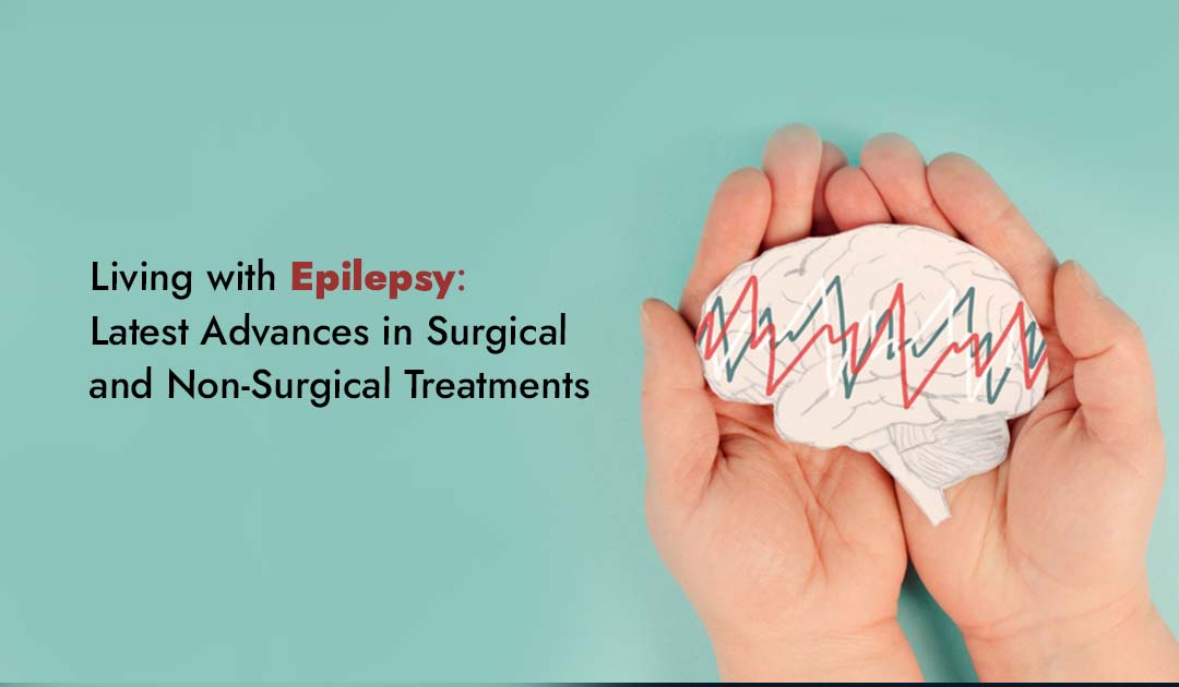 Living with Epilepsy: Latest Advances in Surgical and Non-Surgical Treatments