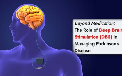 Beyond Medication: The Role of Deep Brain Stimulation (DBS) in Managing Parkinson’s Disease