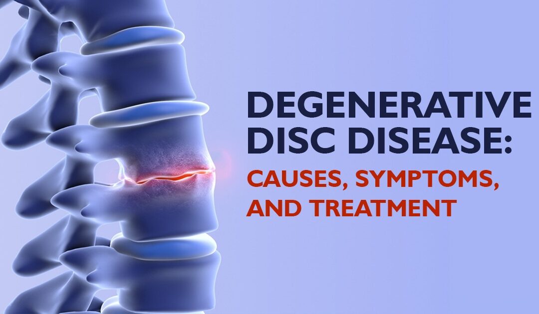 Degenerative Disc Disease: Causes, Symptoms, and  Treatment