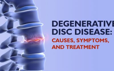 Degenerative Disc Disease: Causes, Symptoms, and  Treatment